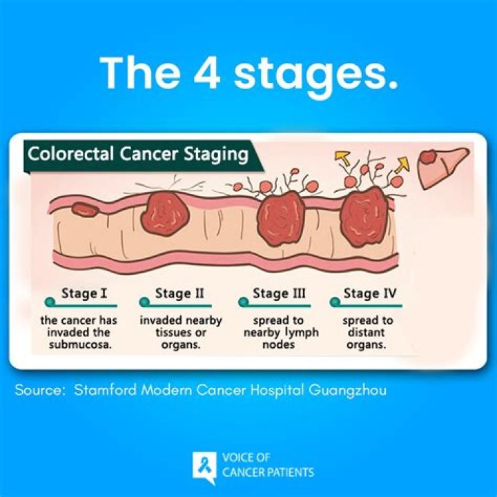 Bravery in the Face of Adversity: The Pioneer Woman's Battle with Stage 4 Colon Cancer