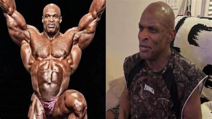 The Truth About Ronnie Coleman Now: Uncovering the Legend's Legacy
