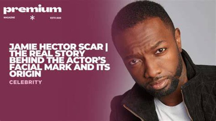 Unveiling the Intriguing Story Behind Jamie Hector's Scar