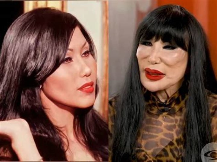 Unveiling the Mystery: What Happened to Lyn May's Face?